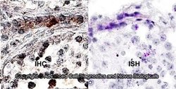 MRP1 Antibody (IU2H10) - Azide and BSA Free, Novus Biologicals 0.1 mL;